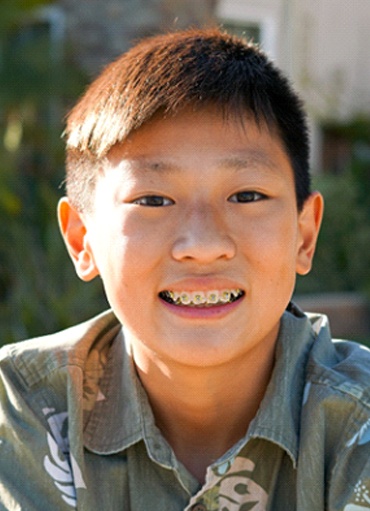 Little girl with braces